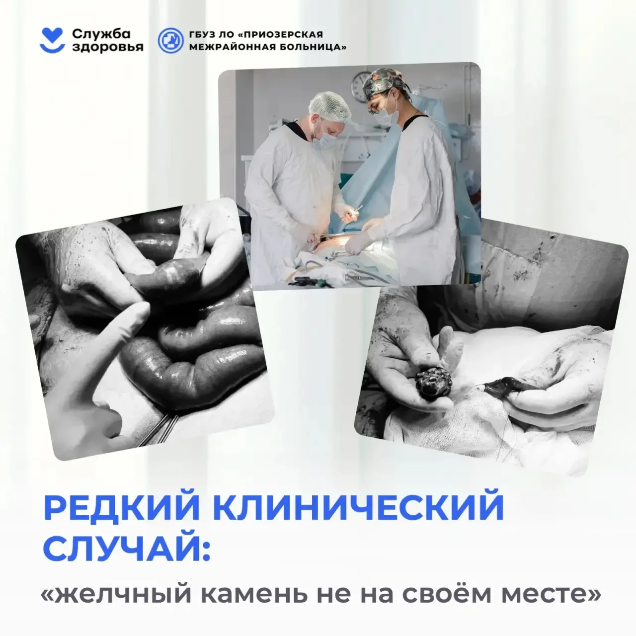 Иногда диагноз преподносит сюрпризы даже опытным хирургам. Из Приозерского района скорая помощь в эк