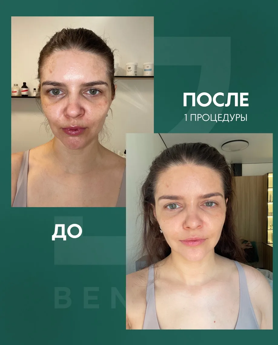 Летом тональный крем — это испытание 

+28 на улице. Вы нанесли тональный, чтобы спрятать купероз и 