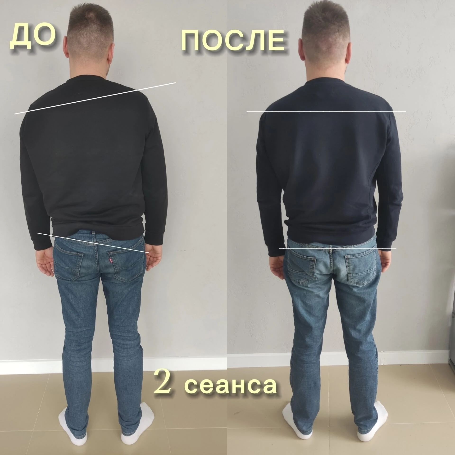ПРАВКА ТАЗА (без хруста)и глубокий спортивный массаж МУЧАЧА

1⃣ «Правка таза» - это мягкая техника, 