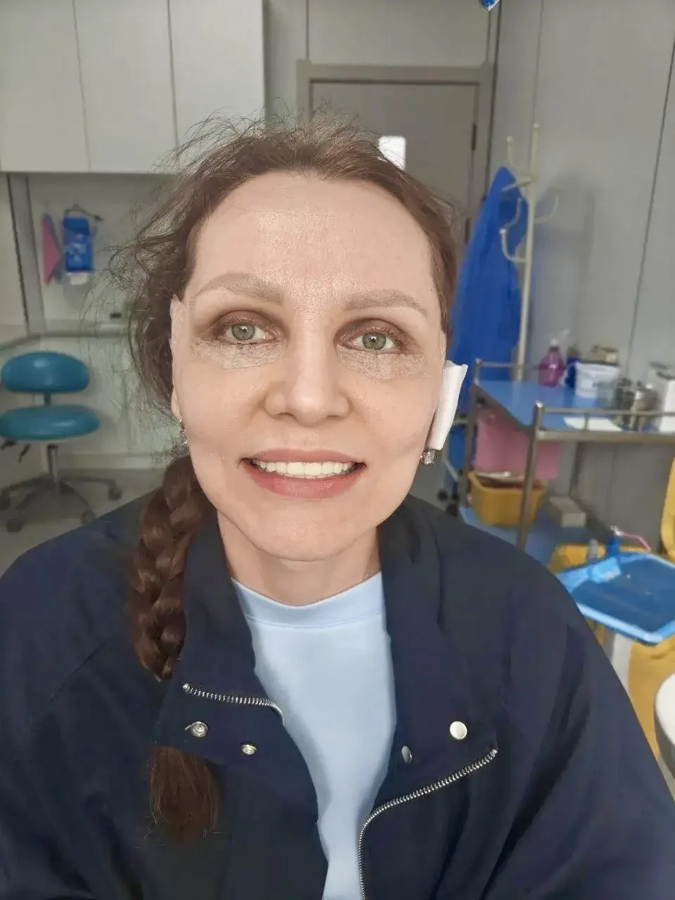 Олеся , город Москва 

🦷План протезирования:
Верх - 3 моста, 14 единиц  
Низ - 4 моста, 13 единиц 
