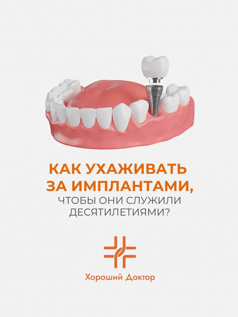 🦷 Как ухаживать за имплантами, чтобы они служили десятилетиями?

Многие пациенты считают, что после