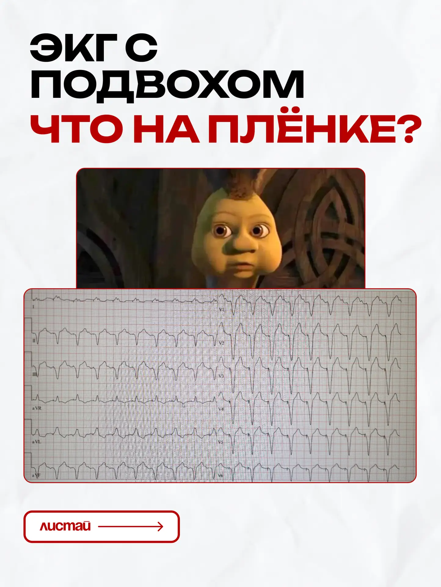 🔥Срочный сбор!

Сегодня подробно разбираем интересную ЭКГ. Листайте карусель.

Так как комментов у 