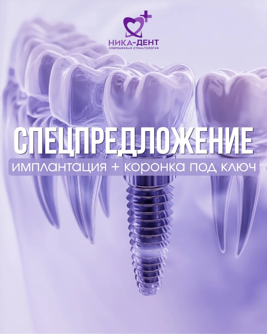 Сэкономьте на имплантации в мае 🎁

Потеряли зуб? Не ждите, пока начнутся проблемы с соседями 🦷 и п