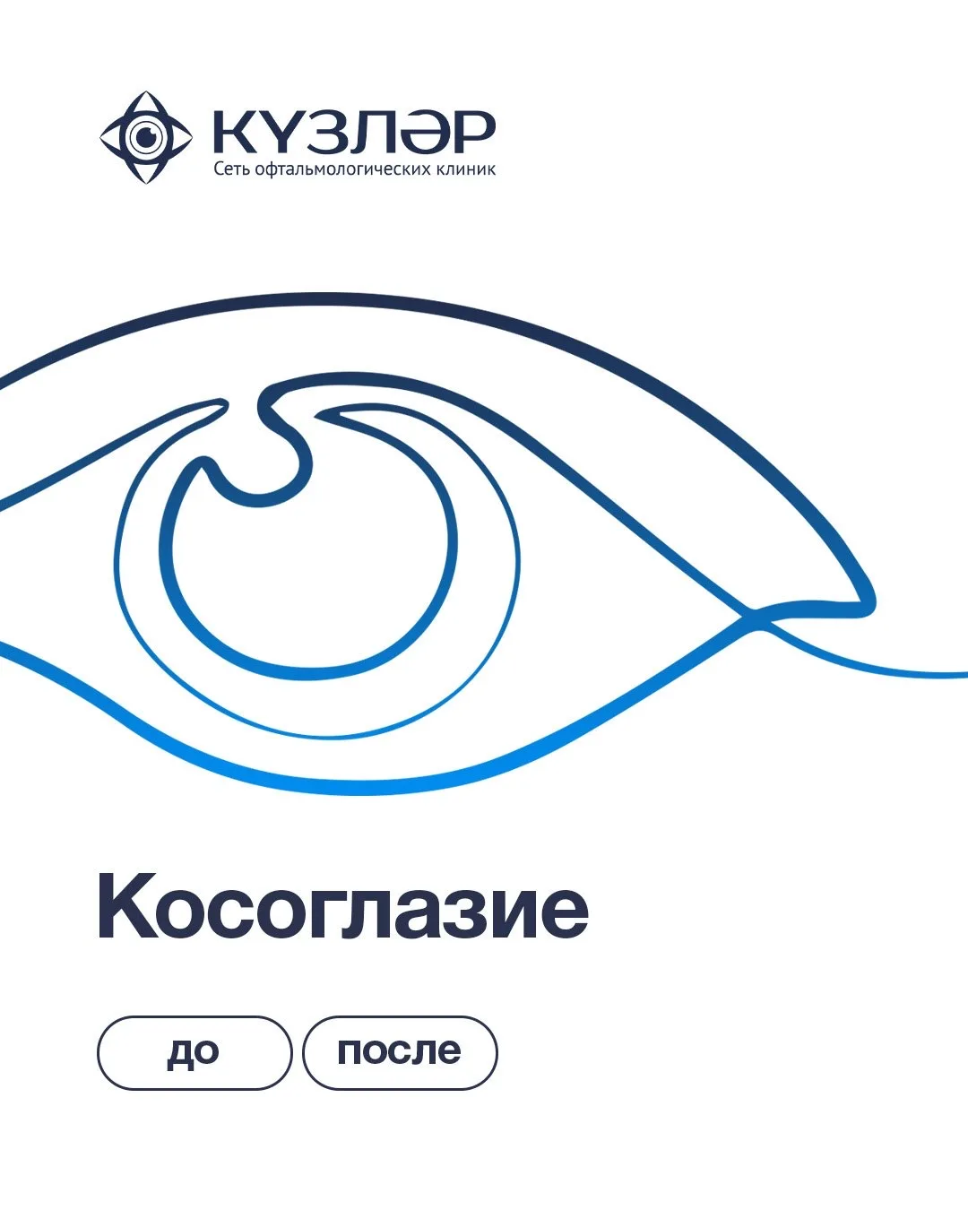 ДО / ПОСЛЕ
ХИРУРГИЯ КОСОГЛАЗИЯ 18+

Представляем вашему вниманию результат операции по исправлению к