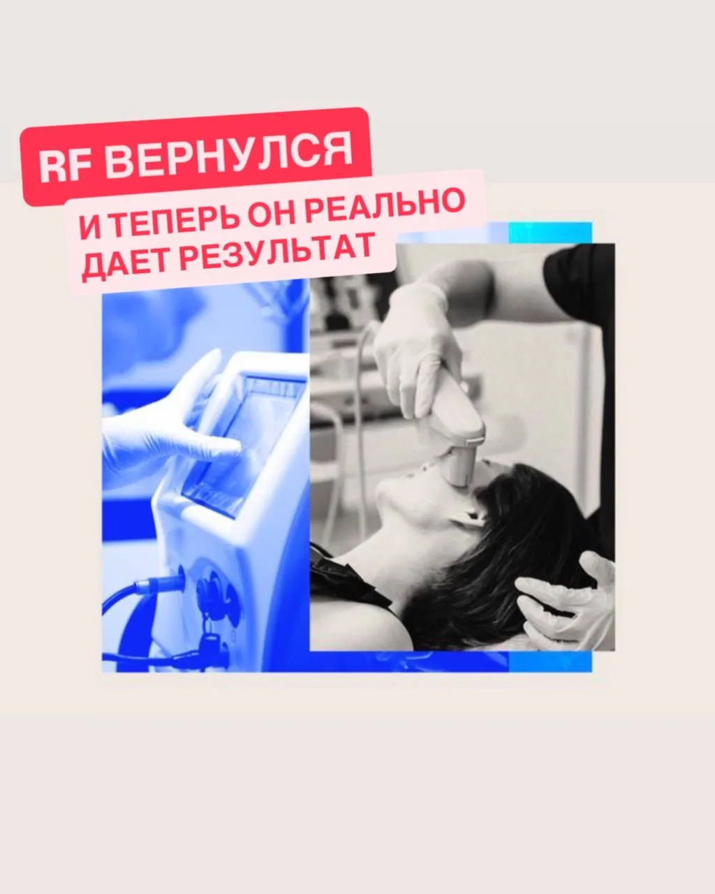 Девочки, если вы думали, что аппаратка «уже всё» — нет 😏👇

💥 RF-лифтинг вернулся. И теперь он реа