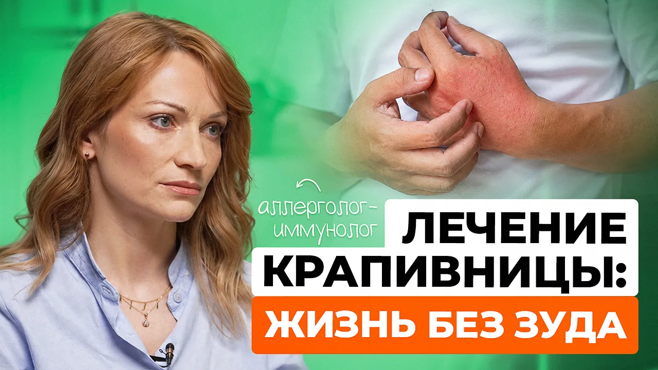 Крапивница: причины и современное лечение

Часто крапивницу списывают на аллергию, но причины могут 