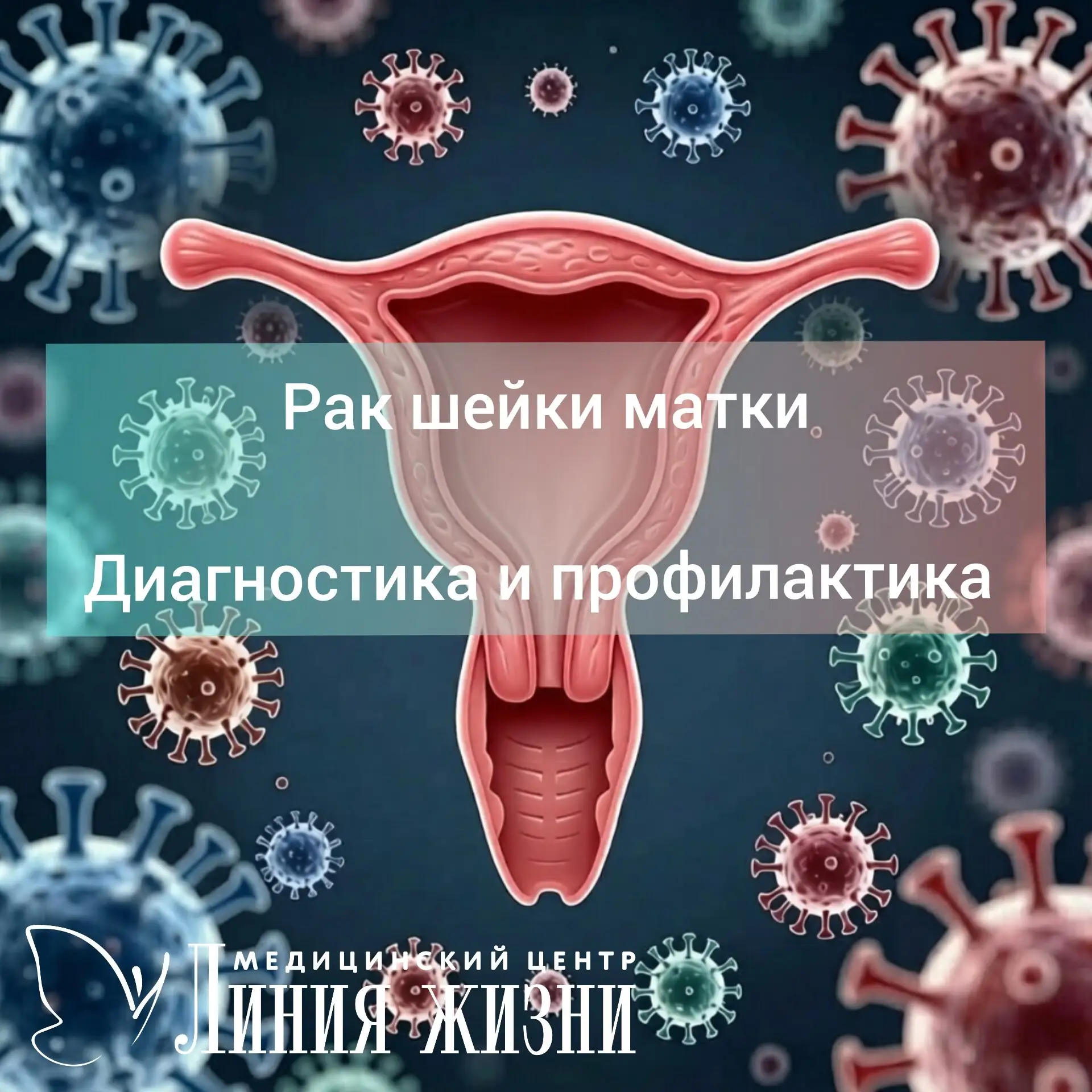 Самый коварный рак🧬
 
Рак шейки матки (РШМ), согласно данным Международного агентства по изучению р