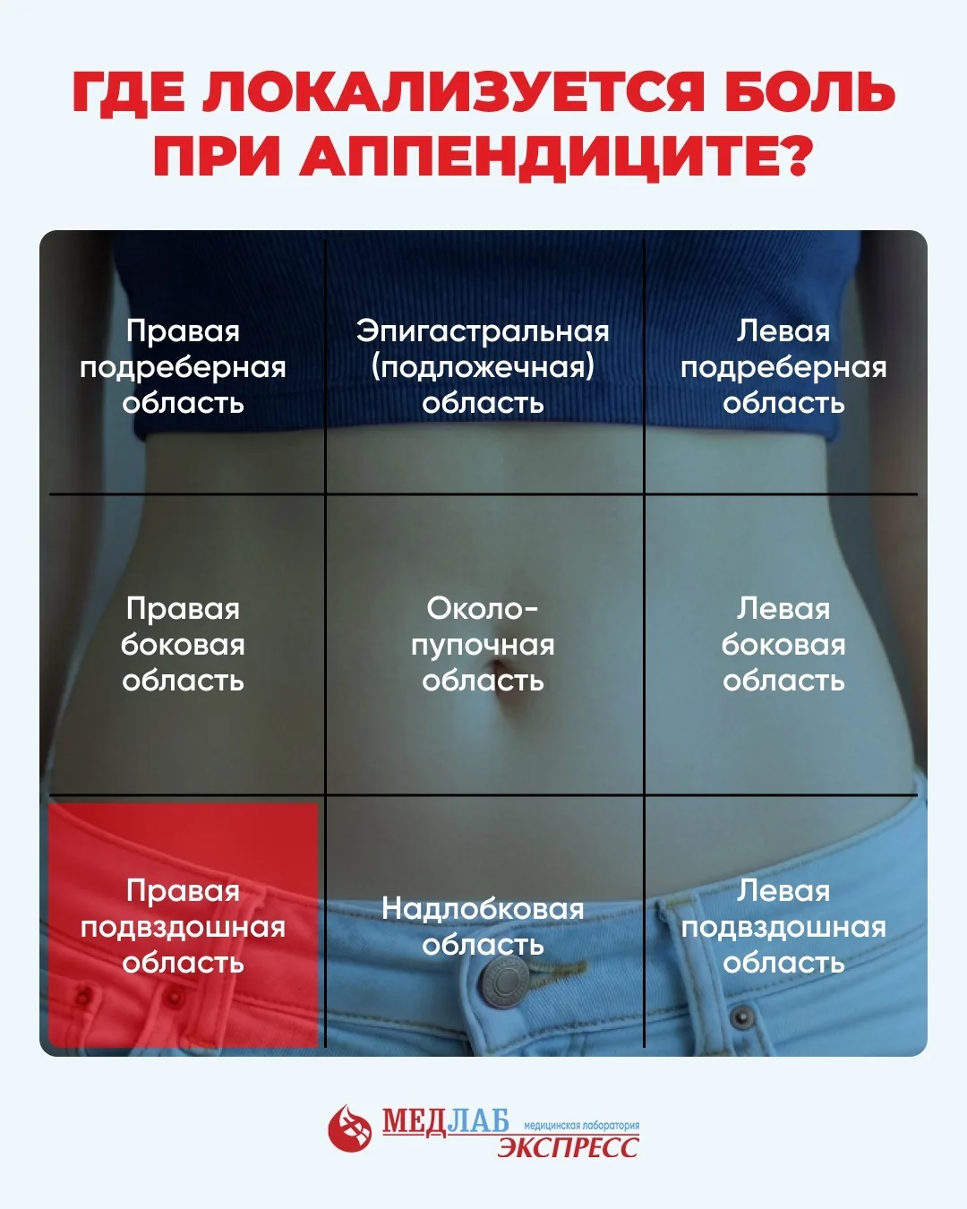Когда появляется сильная боль в животе, особенно сбоку, часто первая мысль — аппендицит. Но на деле 