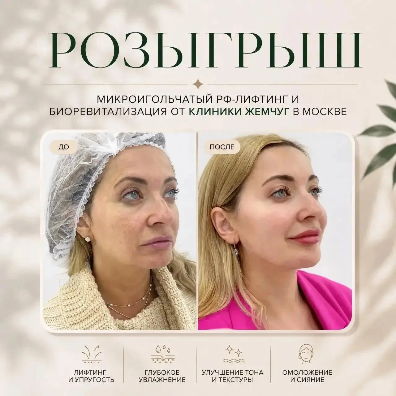 Москва, честный розыгрыш микроигольчатого RF-лифтинга и биоревитализации в разгар лета! 💋

Здравств
