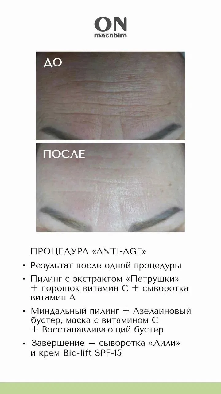КЕЙС: ANTI-AGE ЗА 1 ПРОЦЕДУРУ НА КОСМЕЦЕВТИКЕ ONMACABIM ОТ КОСМЕТОЛОГА 👇

Этап 1. Подготовка и эксф