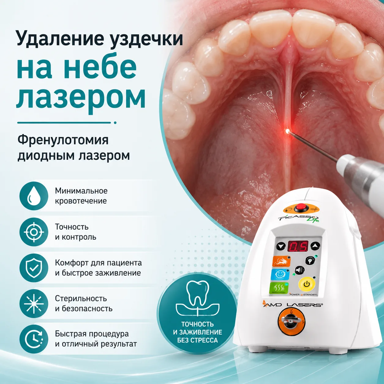Френулотомия нёбной уздечки и диодный лазер

Коррекция уздечек остаётся одной из самых распространён
