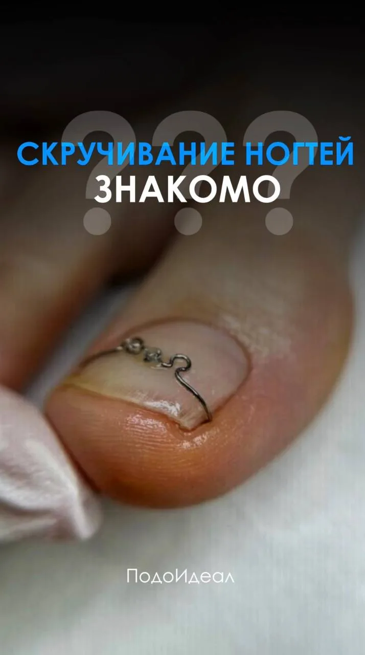 Скручивание ногтей - знакомо?

✅Записаться:✅

✅В личных сообщениях группы
✅По телефону: 500-665
✅нап