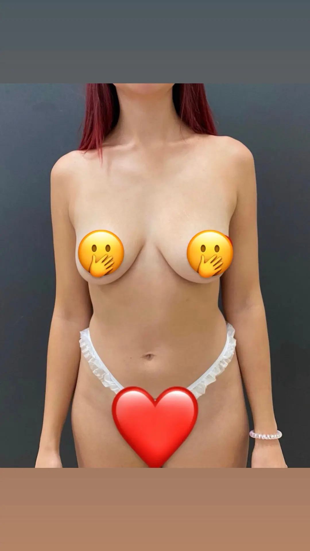 Моя грудь до операции 😭
❌ Пост 18+ 

Вы смотрите и видите очень красивую картинку, я тоже.. 
пока н