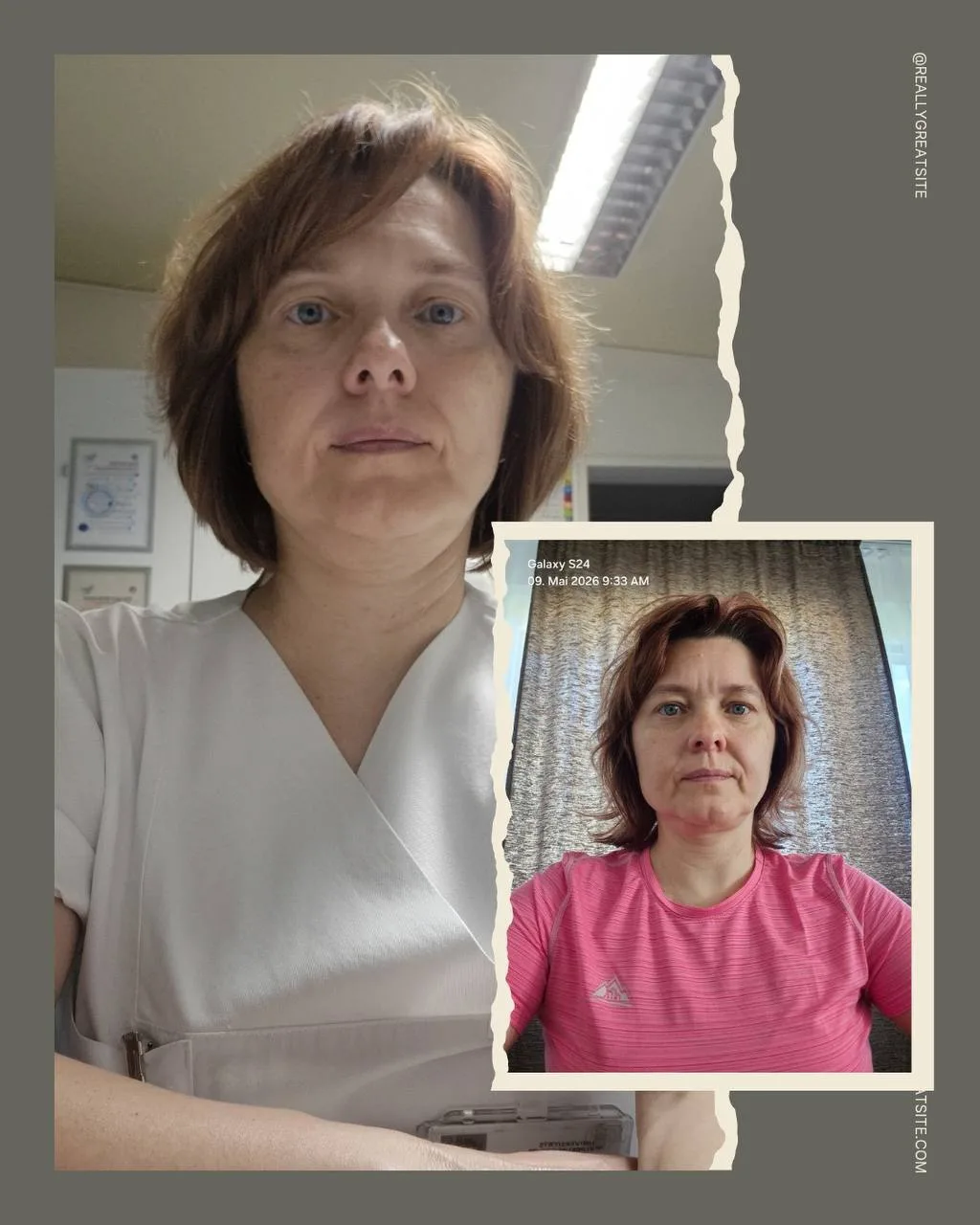 Фото нашей ученицы как раз с программы «Экспресс Омоложение»⬆️

В розовом фото «до», можно увеличить