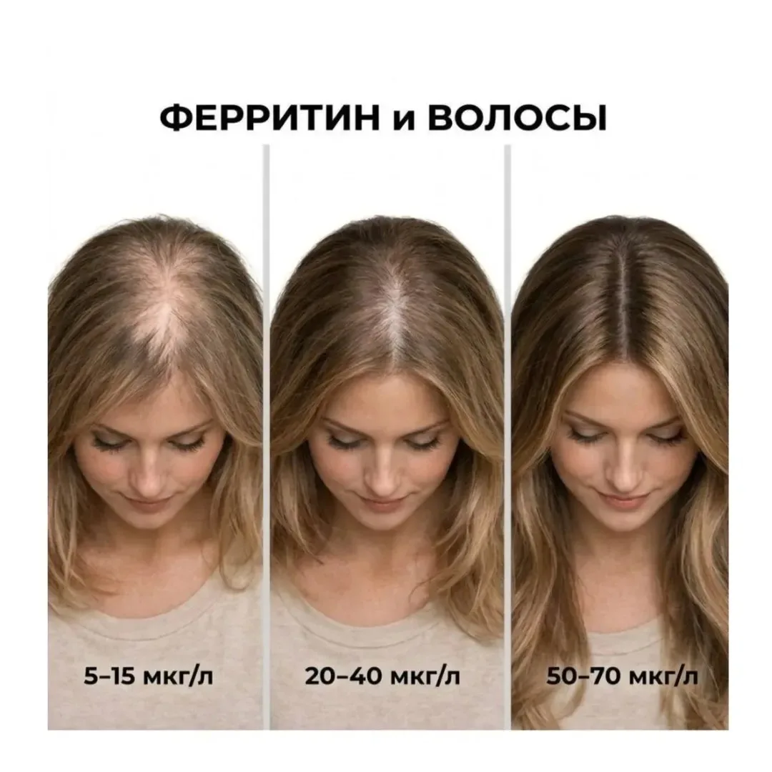 Пьёте железо, а ферритин всё равно низкий?🤔

Знакомо?

Потому что просто пить его — часто путь в ни