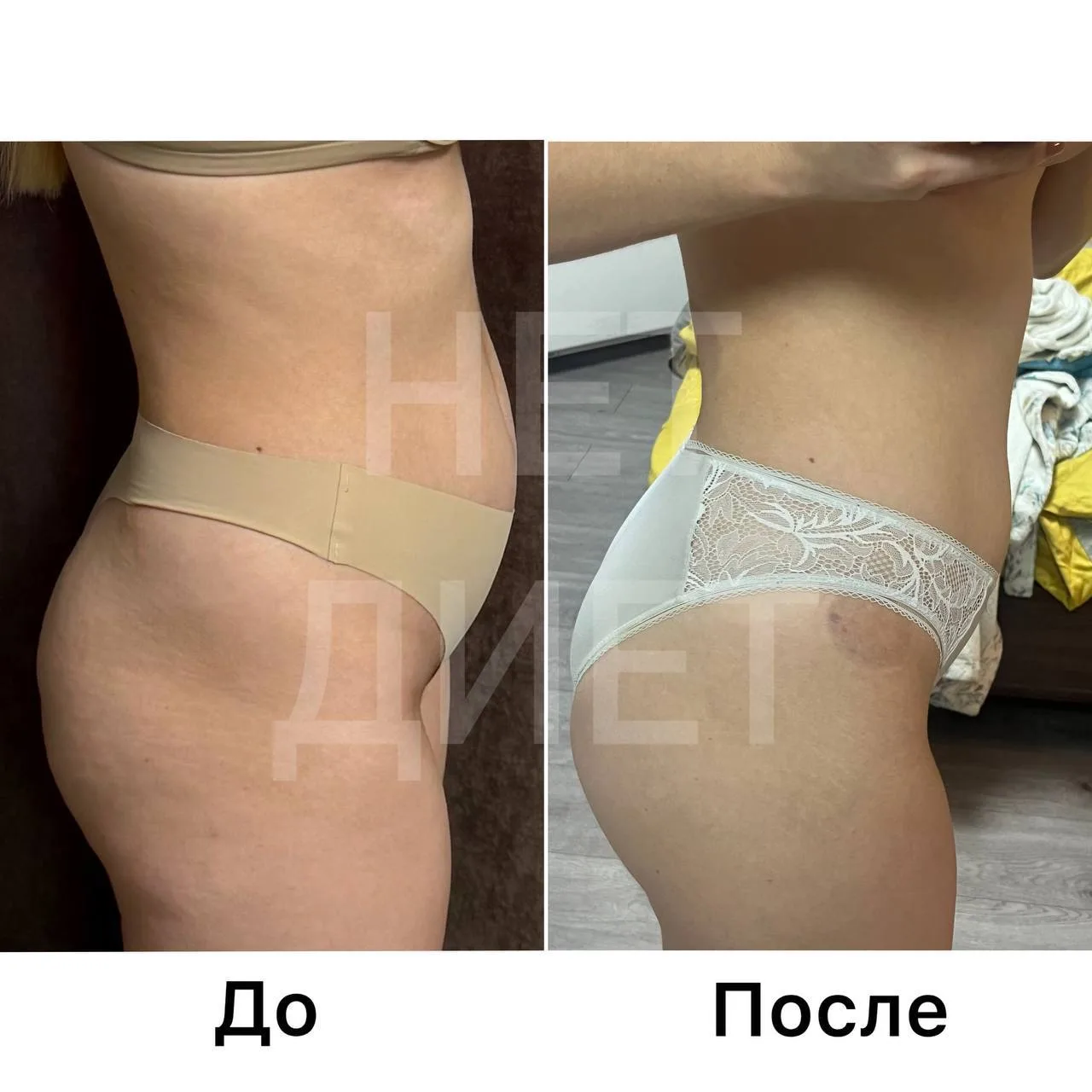 РЕЗУЛЬТАТ МОЕЙ ПОДОПЕЧНОЙ МАРИИ 🩵

Её основные жалобы:
 — постоянное вздутие живота,увеличение объё