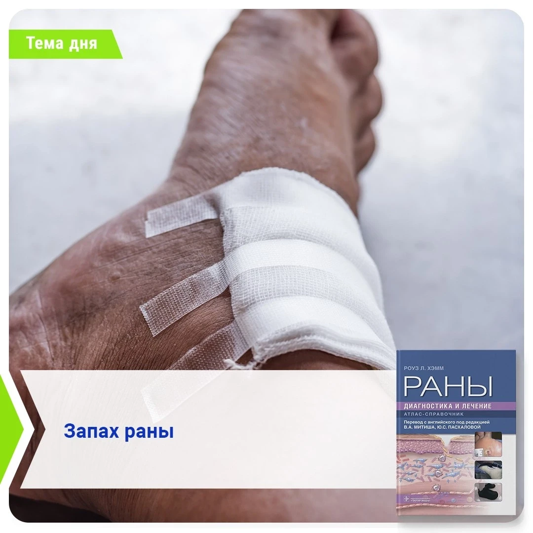 Запах раны

…Запах раны – важный признак, который следует учиться распознавать. При перевязке любой 