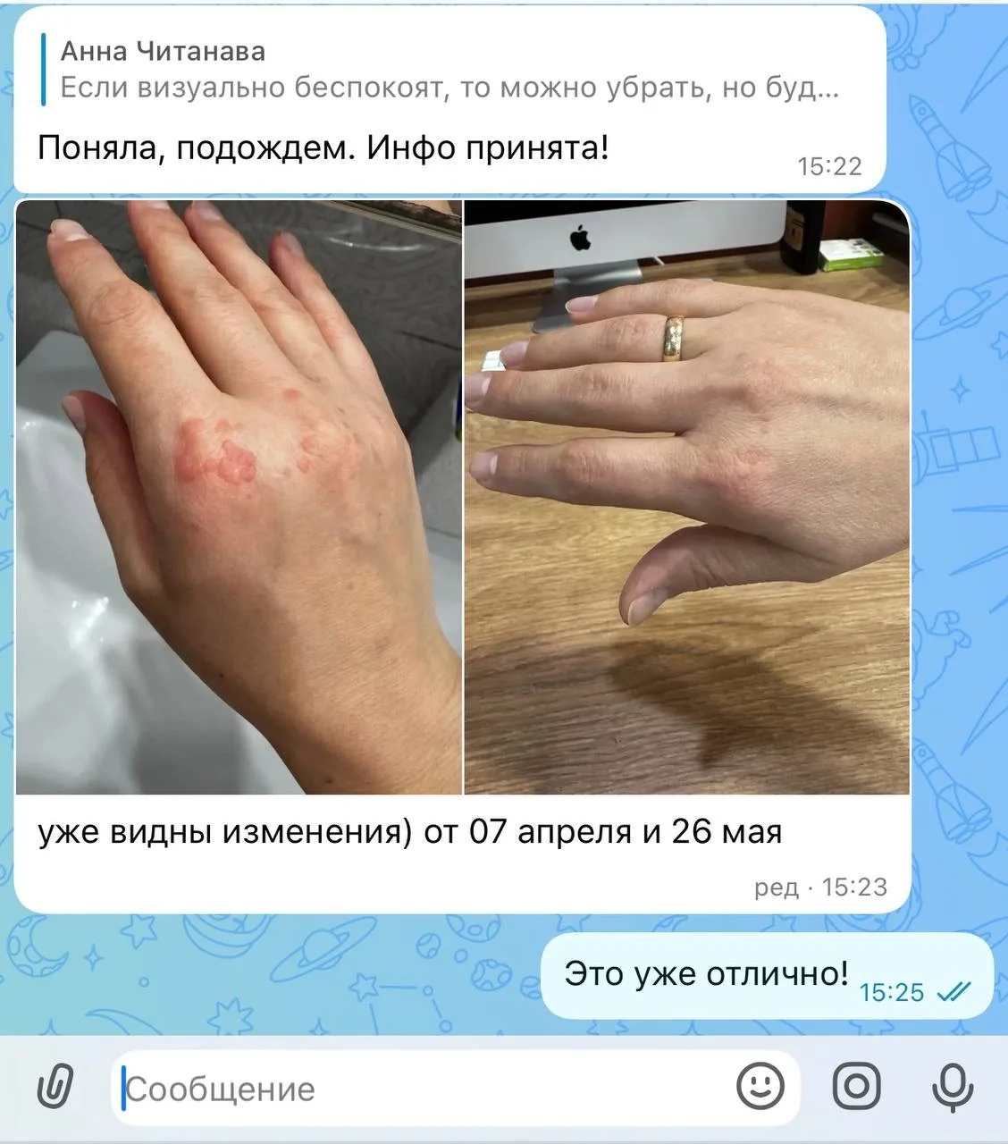 Ключ к кожным проблемам - в иммунитете и работе кишечника ☝🏼

Многие привыкли лечить кожу исключите
