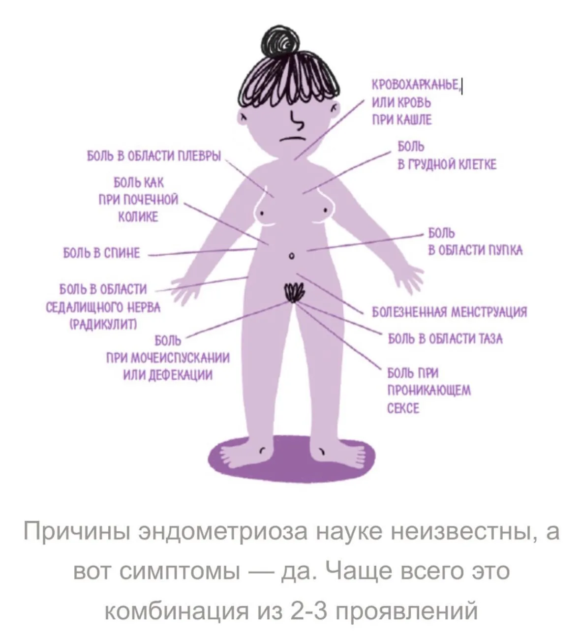 Продолжаю разбирать заявки! Сегодня начнём обсуждать эндометриоз. 

Краткий ликбез👇

Это хроническо