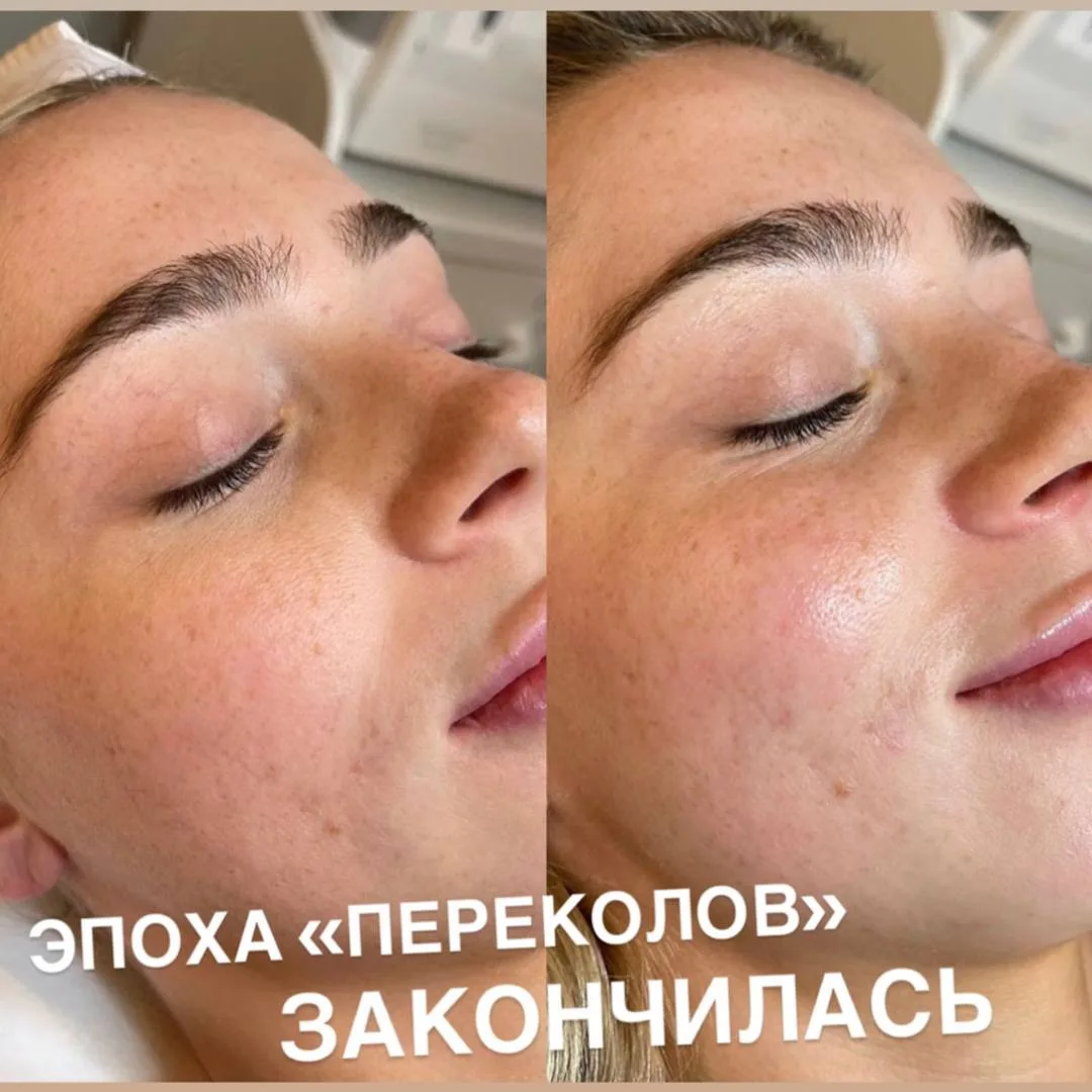 Девочки, официально: эпоха “переколов” — всё, закончилась 🙈👇

💥 Натуральность победила

И это не 