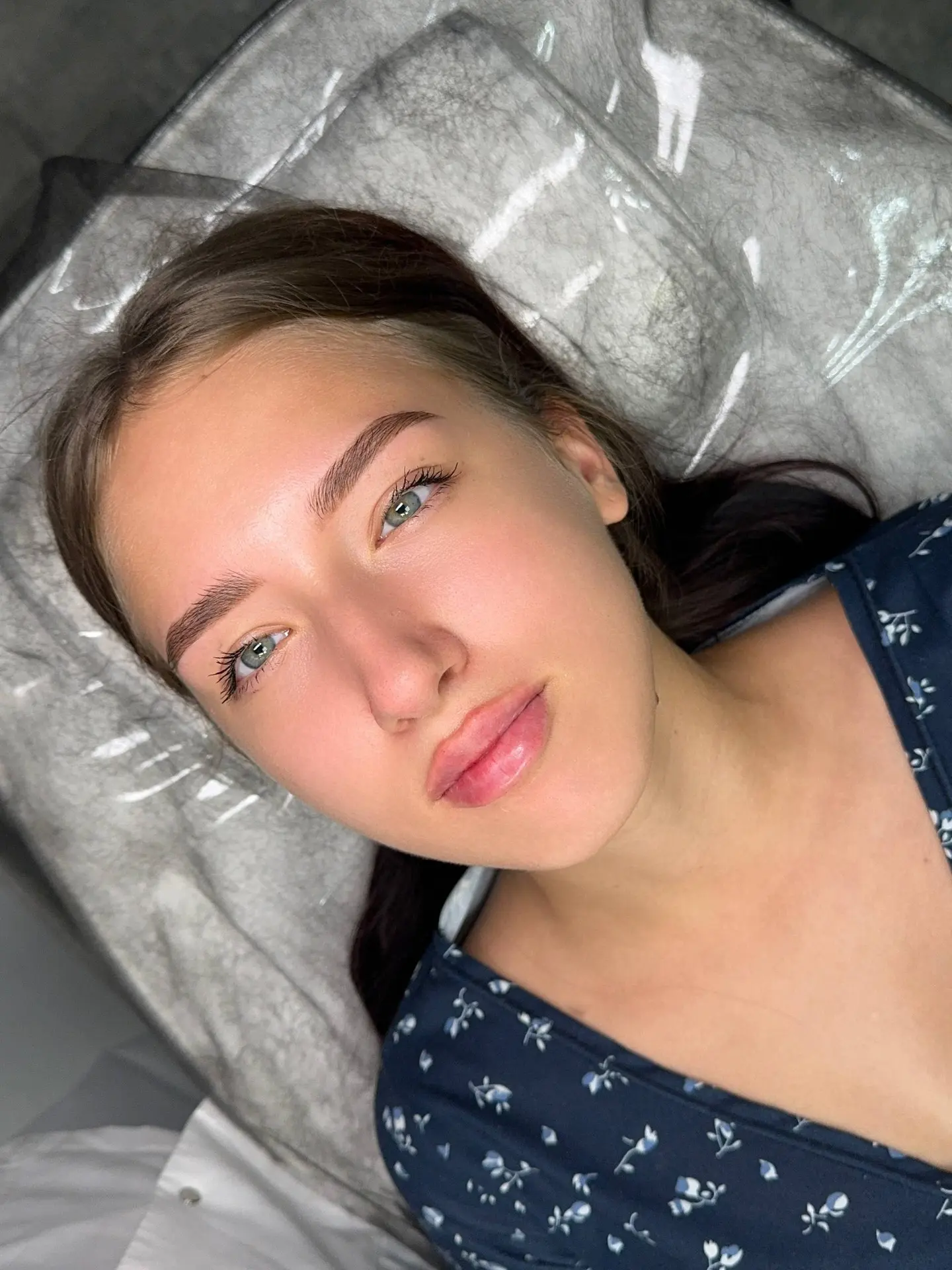 Нежное увеличение губ❤️

▫️Объем: 1 мл
▫️Время работы: 5 минут + 15 минут анестезия 
⠀
Запись👇🏻
IB