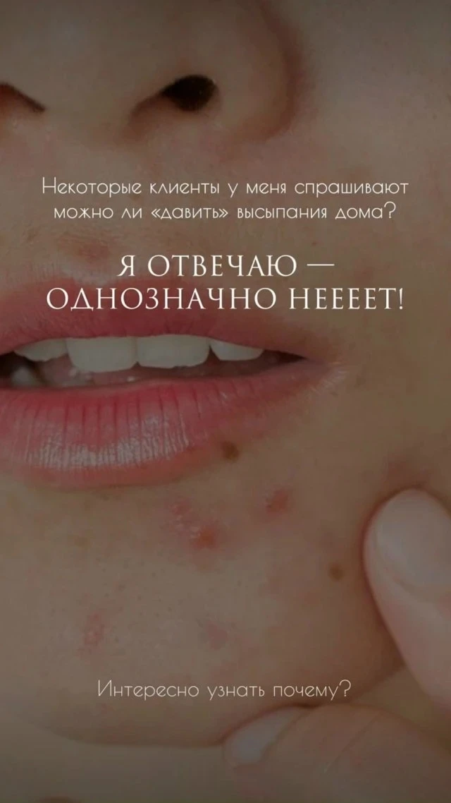 Вы всё ещё «давите»? 😬

Стоп. Это то, что делает кожу хуже, а не лучше.

❌ воспаления
❌ пятна и руб