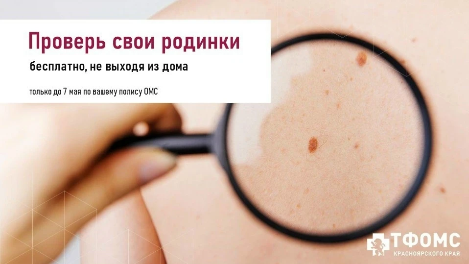 Дивногорск | Красноярск🏡

🔍 Проверьте свои родинки бесплатно по полису! 

 Солнце становится всё а