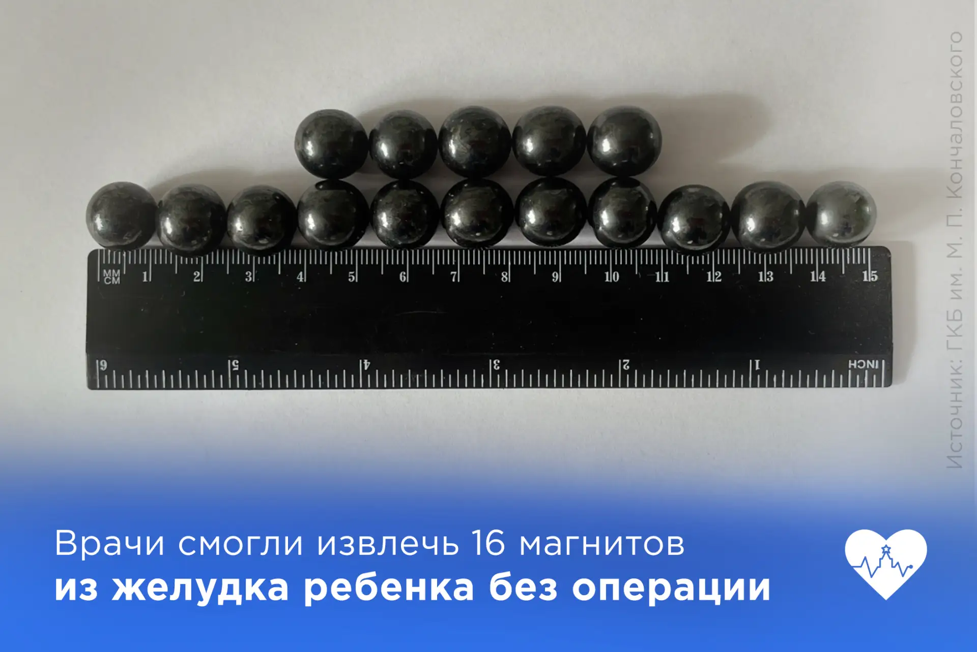 😱 Врачи спасли девочку проглотившую 16 магнитов

Ребенка экстренно доставили в приемное отделение Д