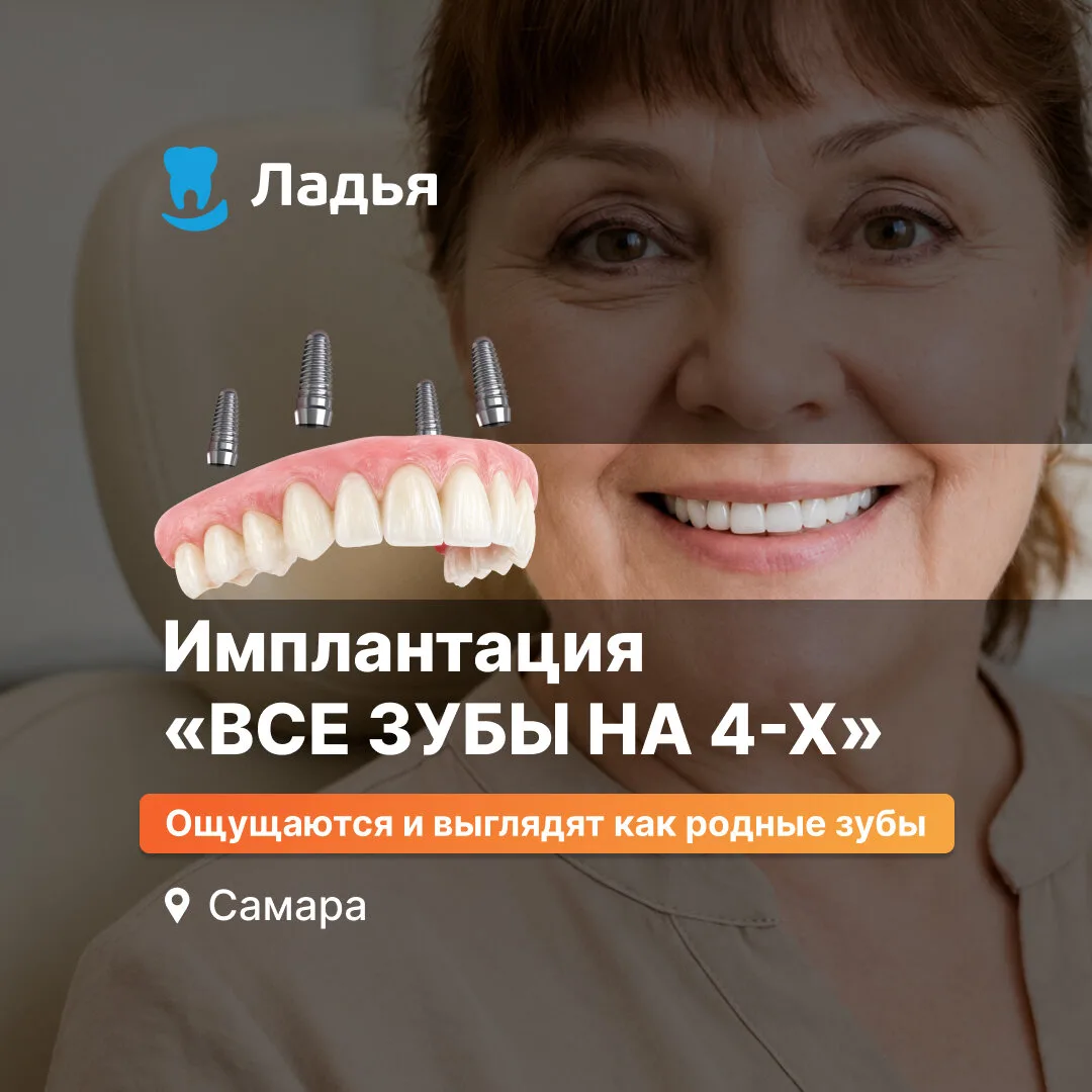 Имплантация всей челюсти на 4-х имплантах за 1 день!

Установим несъёмный протез на 4-х имплантах с 