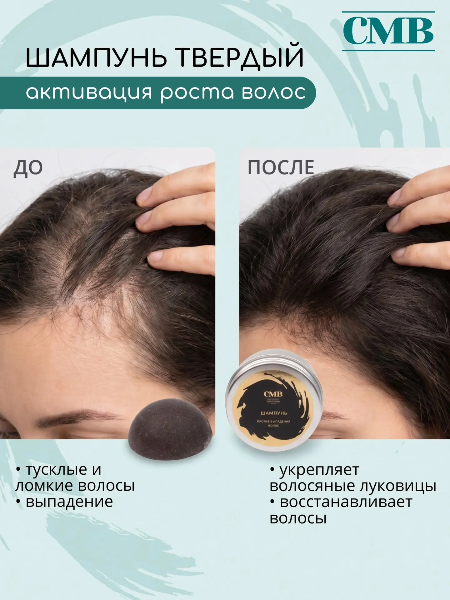 Если волосы быстро жирнеют, объёма нет уже к обеду, вы замечаете выпадение — дело часто не в масках 