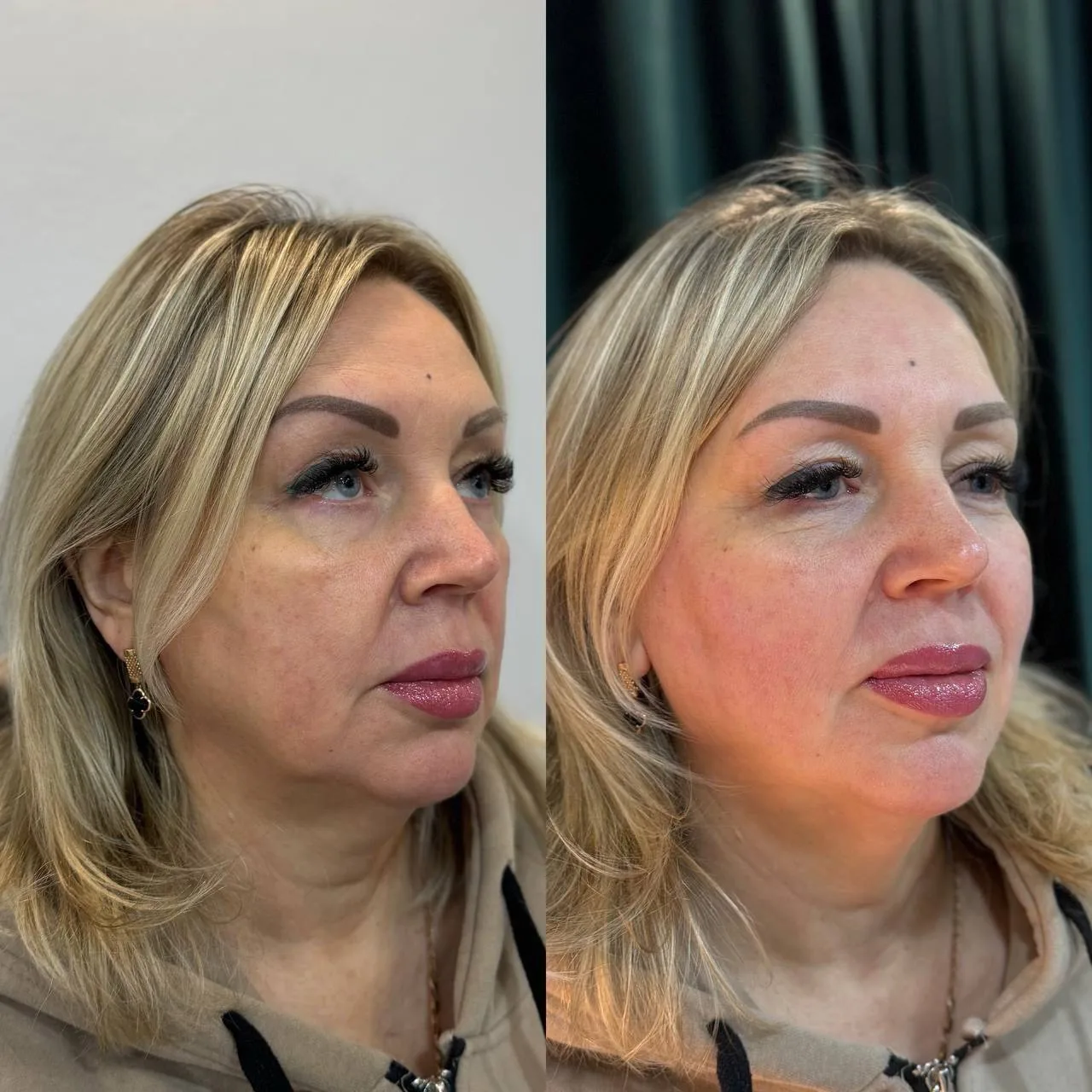 Меня зовут Оксана 
я Врач-Косметолог
Имею высшее медицинское образование ДонНМУ им. М. Горького 📚

