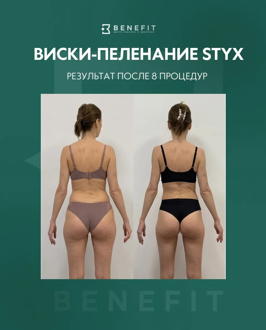 Отёчность, целлюлит, дряблая кожа – даже если вы правильно питаетесь и регулярно тренируетесь?

Прич