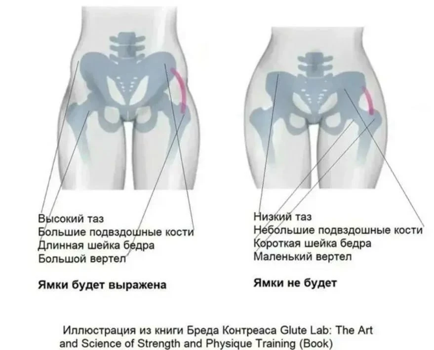 Похудение не поможет, это анатомия!

Сколько разных комплексов впаривают женщинам, чтобы избавится о