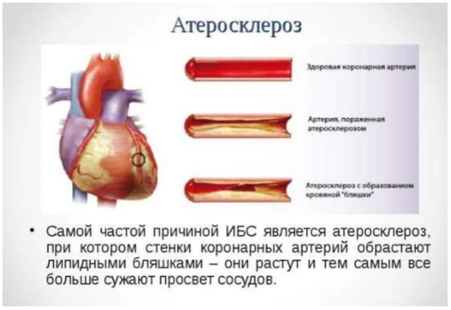 В Университете третьего возраста на факультете «Здоровое долголетие» продолжается курс лекций на тем