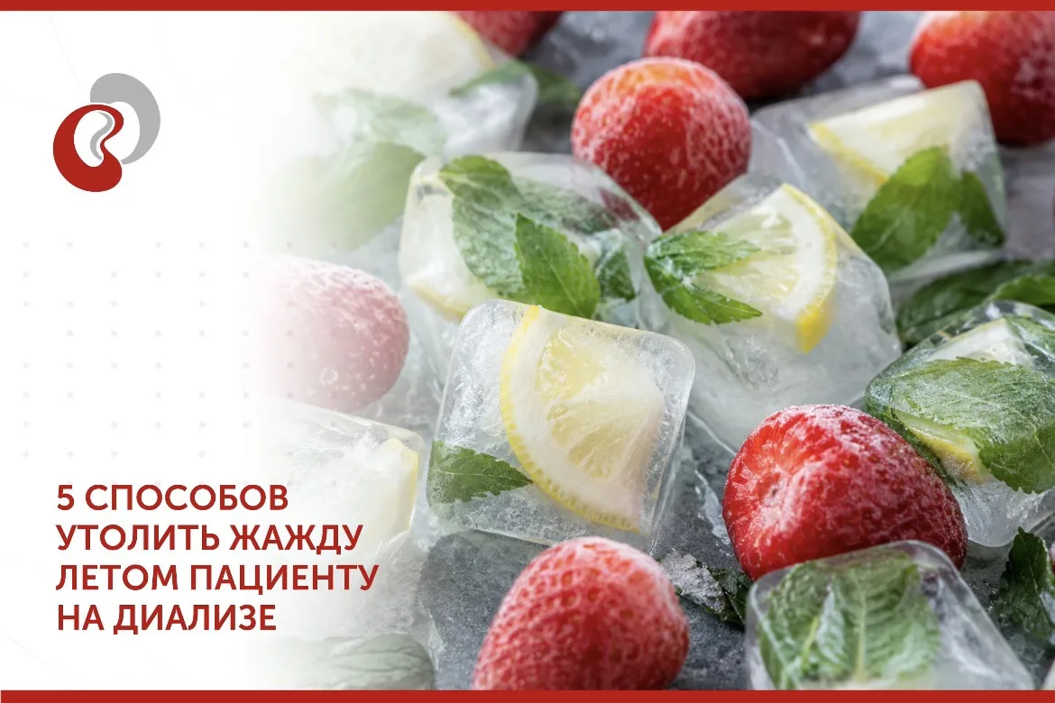 5 неочевидных способов справиться с жаждой летом, если вы на диализе

Лето для диализного пациента —