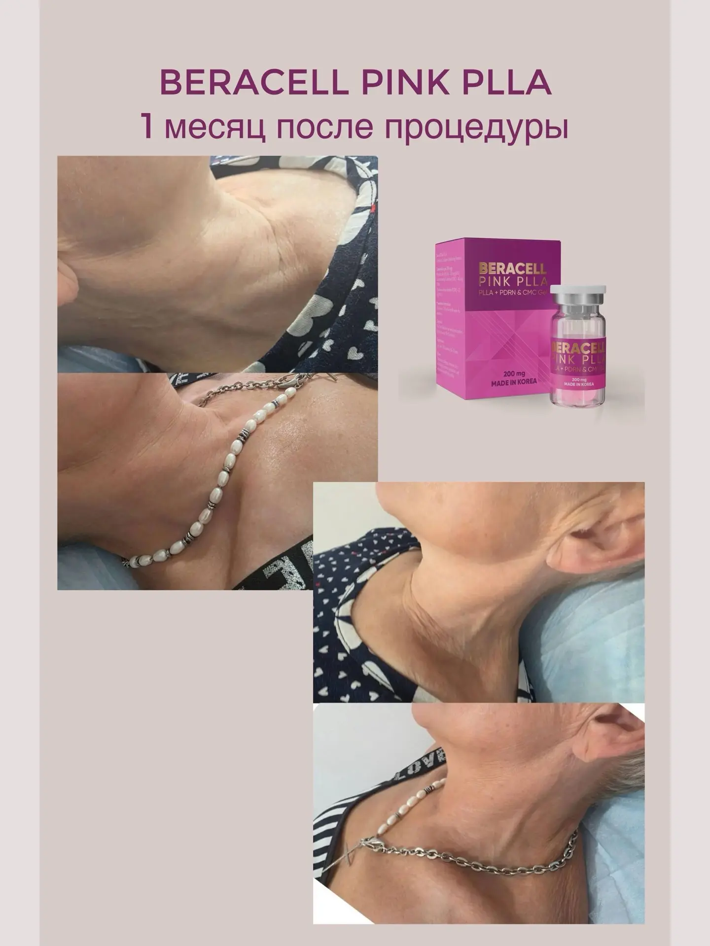 🤩 Коллеги, это тот самый случай, когда за результат хочется аплодировать стоя! 👏🏻

Ловите порцию 