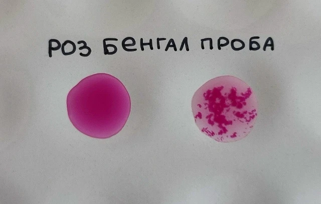 Бруцеллез – хронически протекающая болезнь животных и человека, вызываемая бактериями, объединёнными