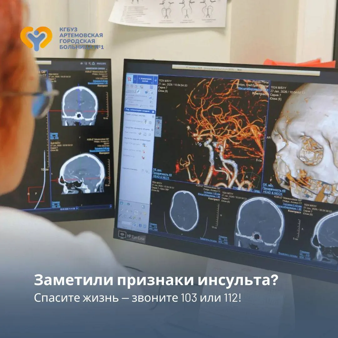 📌 Напоминаем важную информацию: как распознать инсульт?

Запомните три главных признака инсульта (т