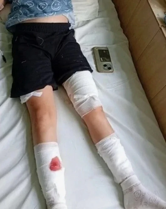 🐕️ Еще одного хозяина собаки, покусавшей ребенка, обязали выплатить компенсацию

В июне у стадиона 