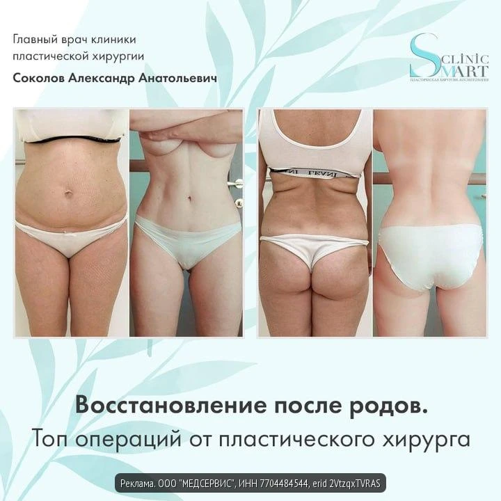 Дорогие мамочки!🤰Беременность и роды — это чудо, но часто они оставляют заметные изменения на теле:
