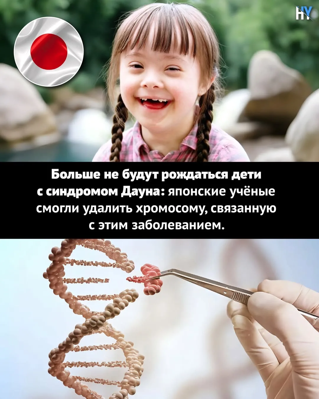 Японские учёные: дети с синдромом Дауна больше не будут рождаться 🧬😬

Новость, которая звучит как 