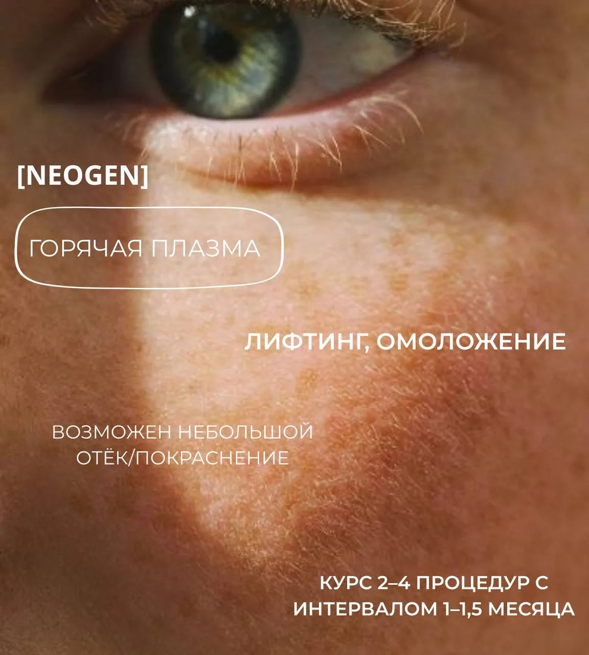 ✨ Горячая и холодная плазма на NEOGEN: вчём разница и какие преимущества? ✨

Аппарат NEOGEN использу