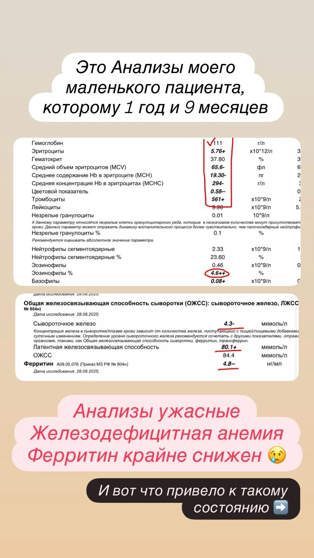 Случай с консультации 
Мальчик, 1 год 9 месяцев 

Жалобы:
‼️был дерматит, но сейчас закончился
‼️сил