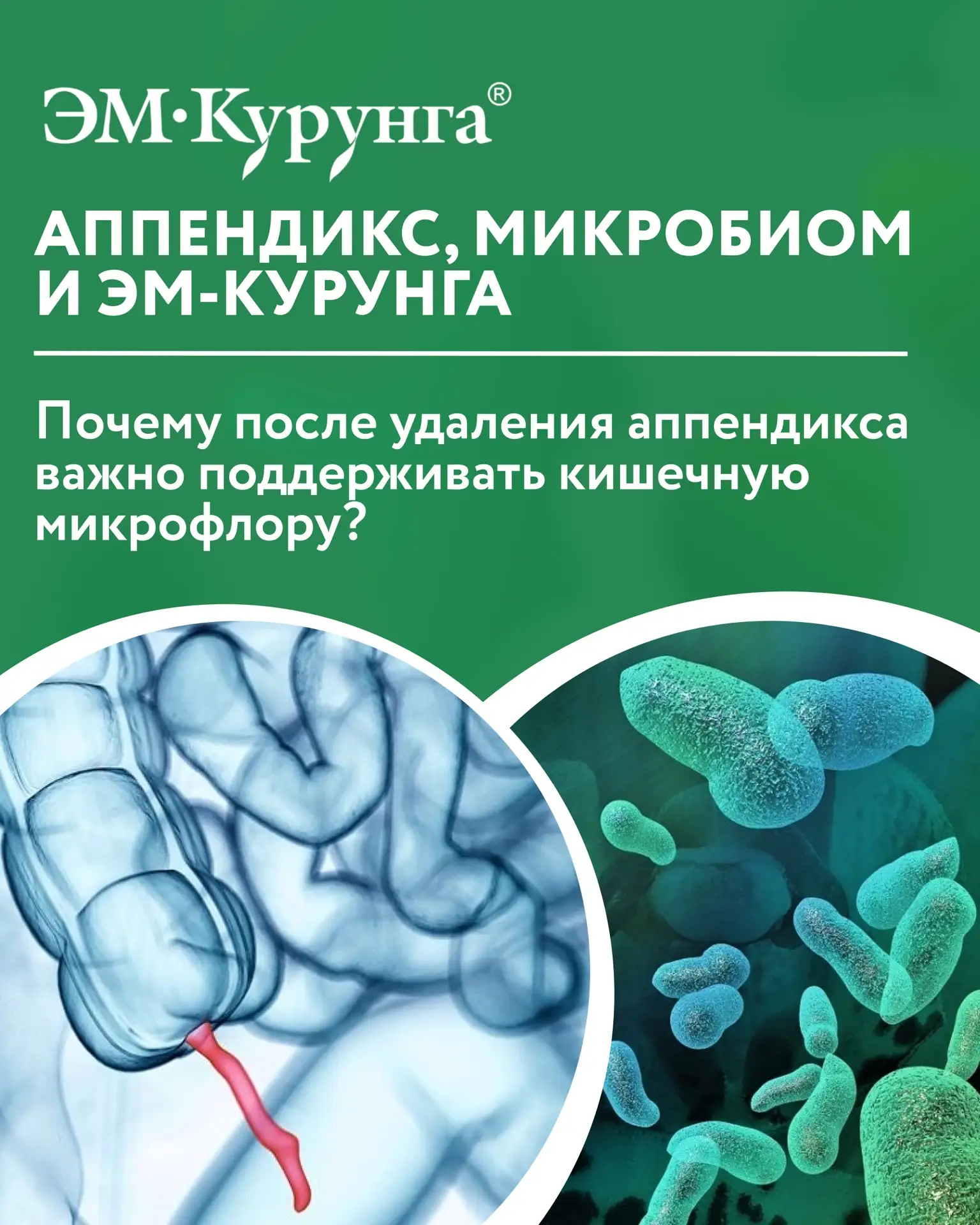 Аппендикс, микробиом и ЭМ-Курунга®

🔬 Долгое время аппендикс считали «лишним» органом. Сегодня иссл