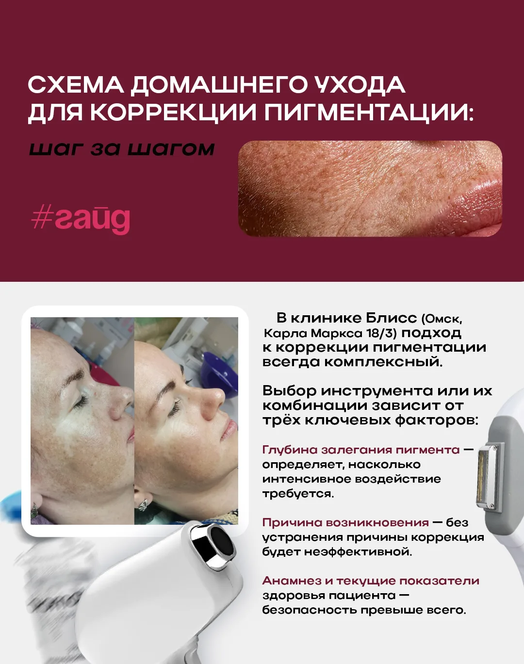 📍Гайд по домашнему уходу за кожей с пигментацией