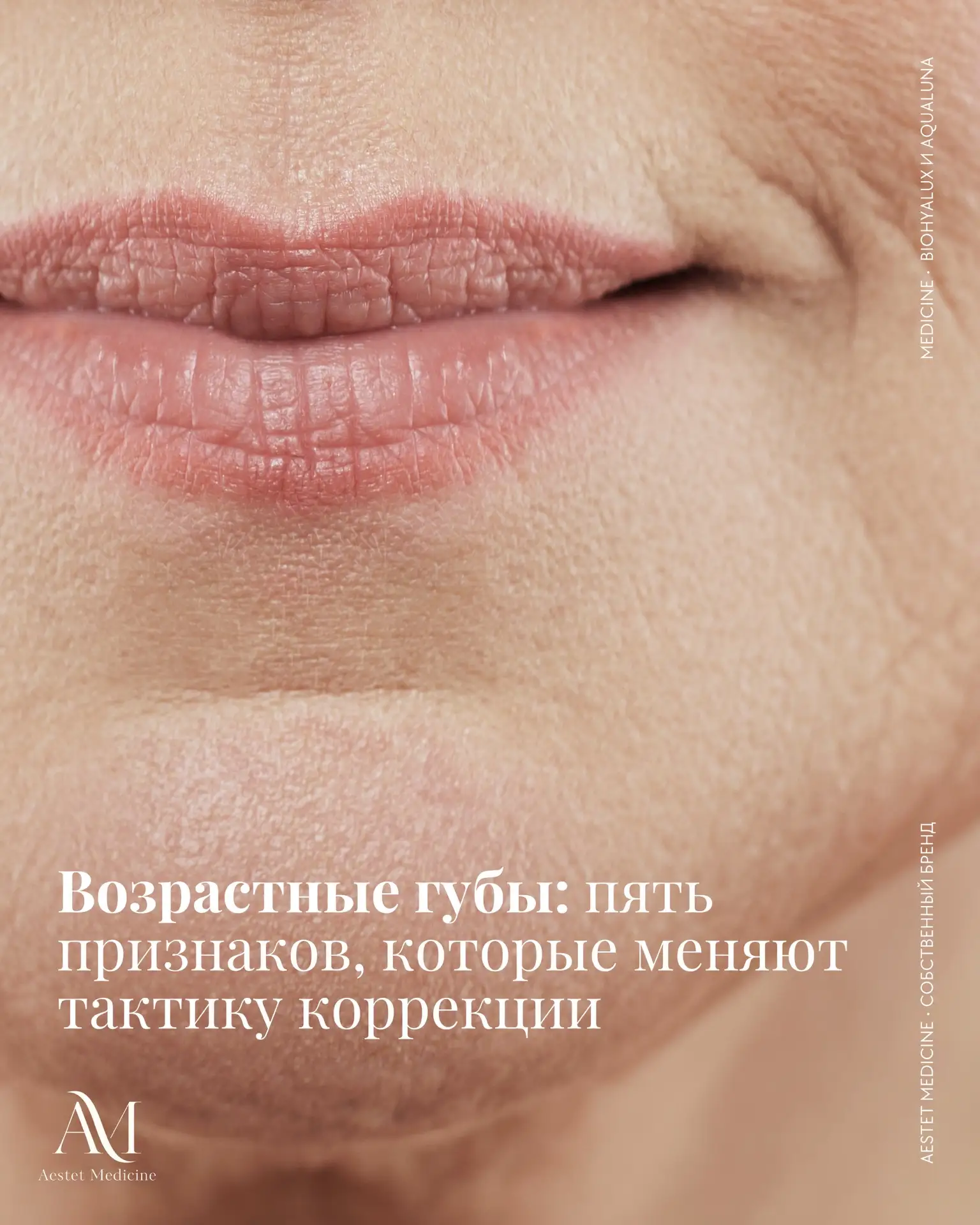 Коррекция губ у пациенток возрастной группы сорок плюс является сложной эстетической задачей. В этот