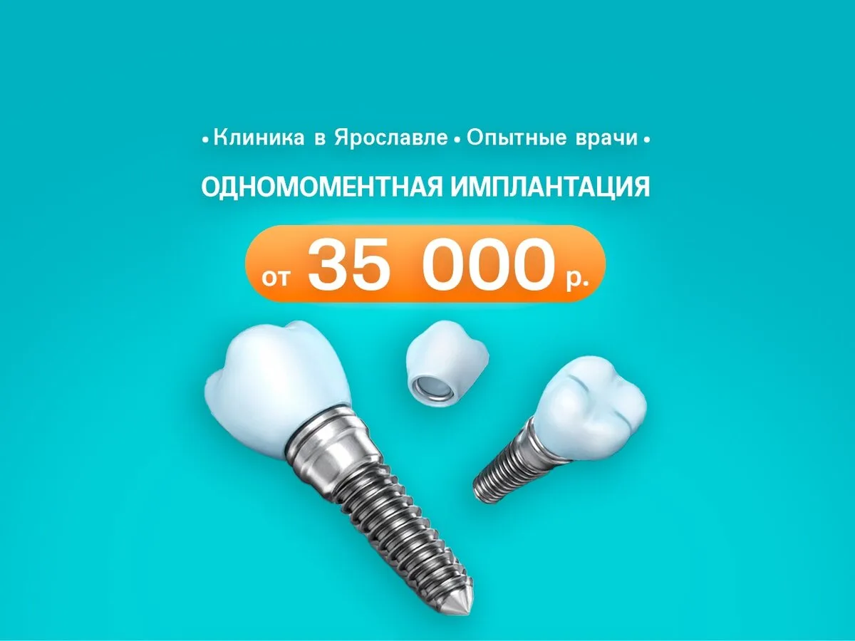 Хотите вернуть зубы — раз и навсегда?

Имплантация — это быстро, безoпаснo и по-честному.

✅ Имплант