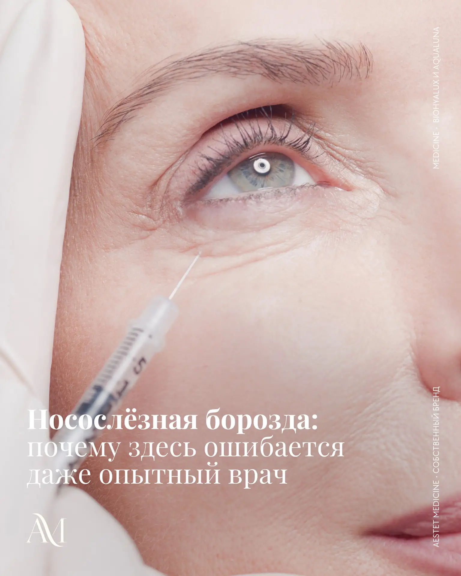 Жалобы на темные круги под глазами и усталый вид — частая причина обращения пациентов в клиники эсте