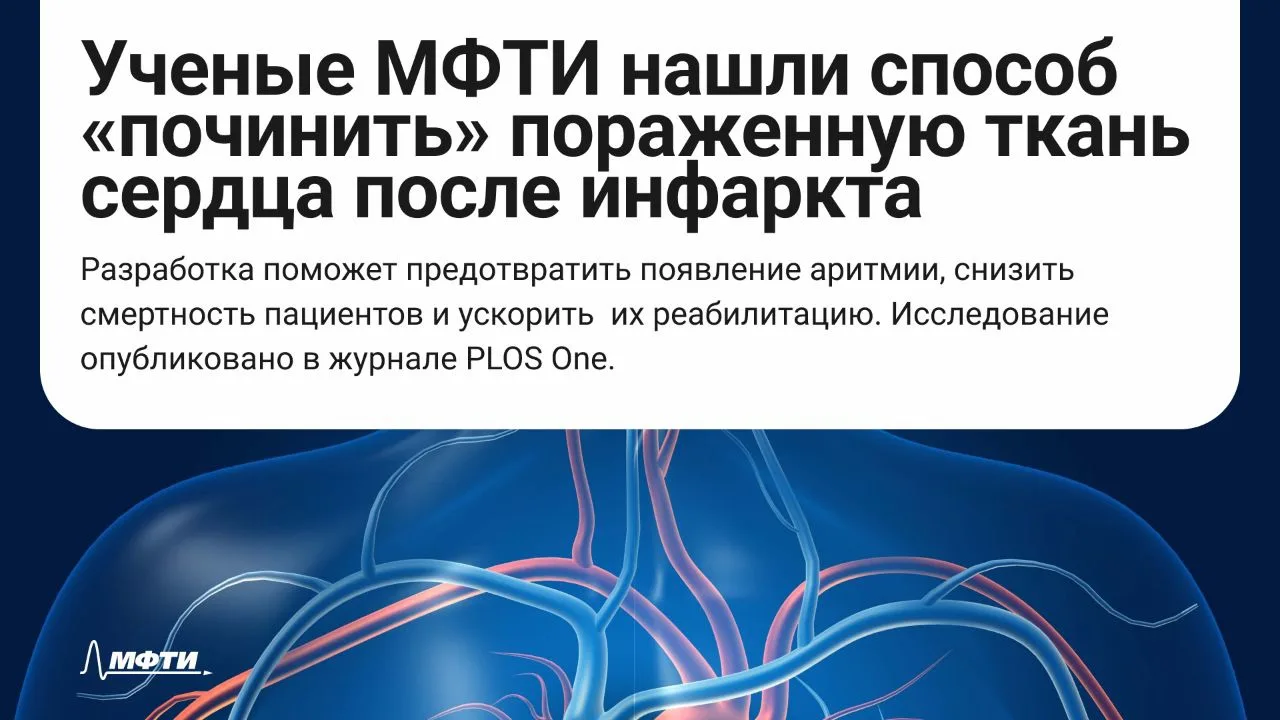 🫀 Инфаркт миокарда перестает быть приговором, а жизнь после него может быть активной и разнообразно