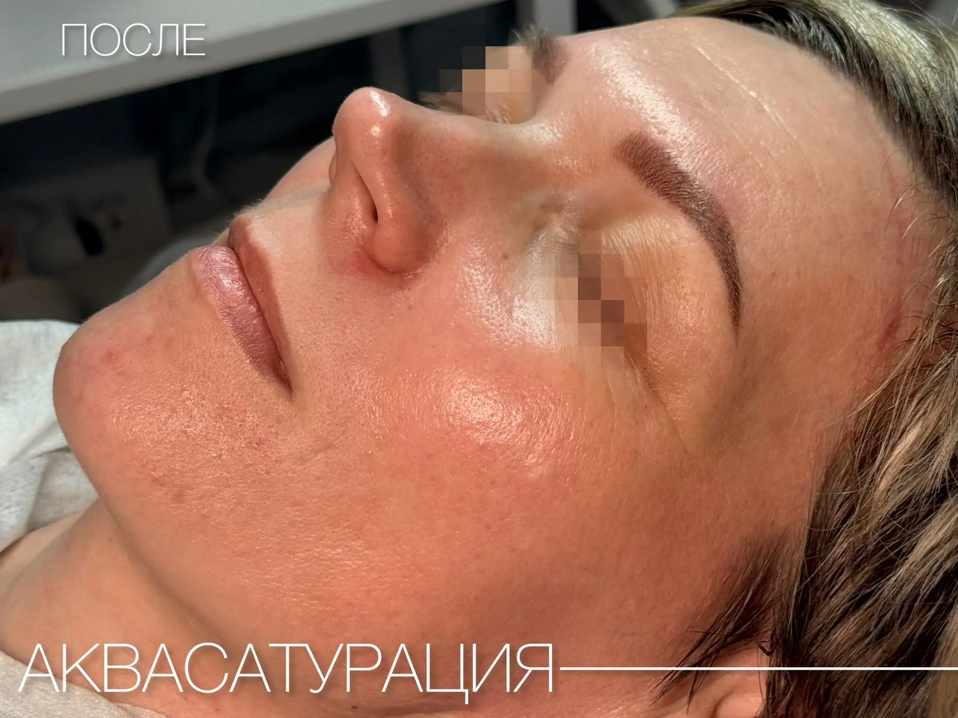 Аквасатурация🤍

Посмотрите, как улучшилось качество кожи🔥

Подарите себе напитанную, подтянутую и 